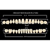 Зубы акриловые цвет B2 (T6, L7, M32) 28 шт. (NMB2T6M32), Yamahachi, Япония